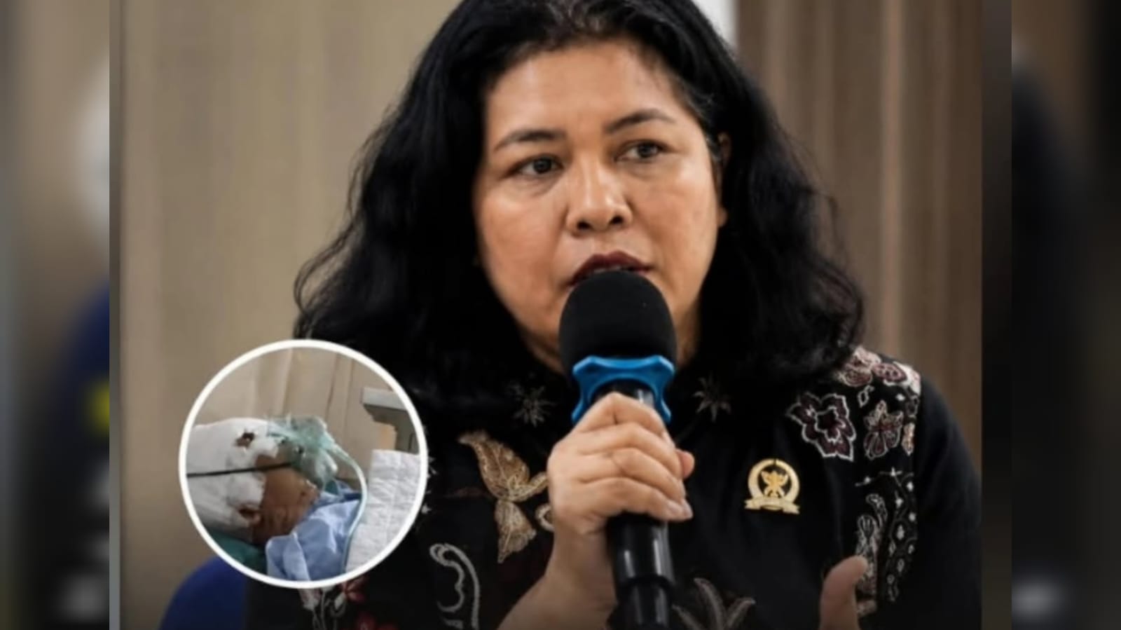 Kondisi Korban Penyekapan: Luka di Kepala Sudah ada Belatung, Tim Khusus Dibentuk Untuk Pemulihan di RSUD Hasan Sadikin
