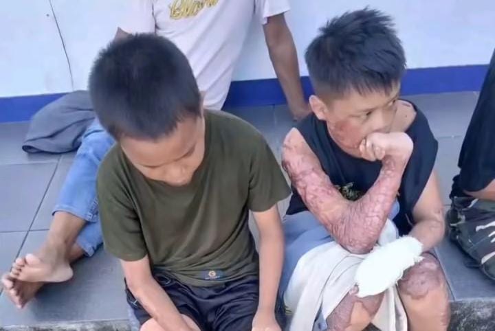 Kasus Pembakaran Tiga Santri di Lombok Tengah: Satu Meninggal Dunia, Dua Luka Berat, dan Misteri Keterlambatan Lapor Yang Mengundang Tanda Tanya
